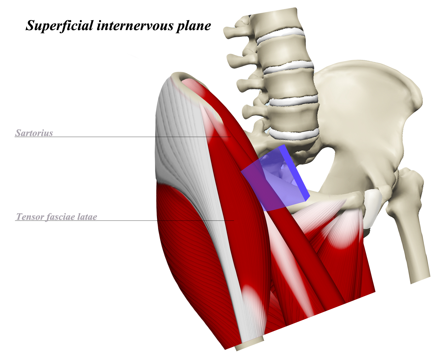 Hip Anterior Approach (SmithPetersen) Approaches Orthobullets
