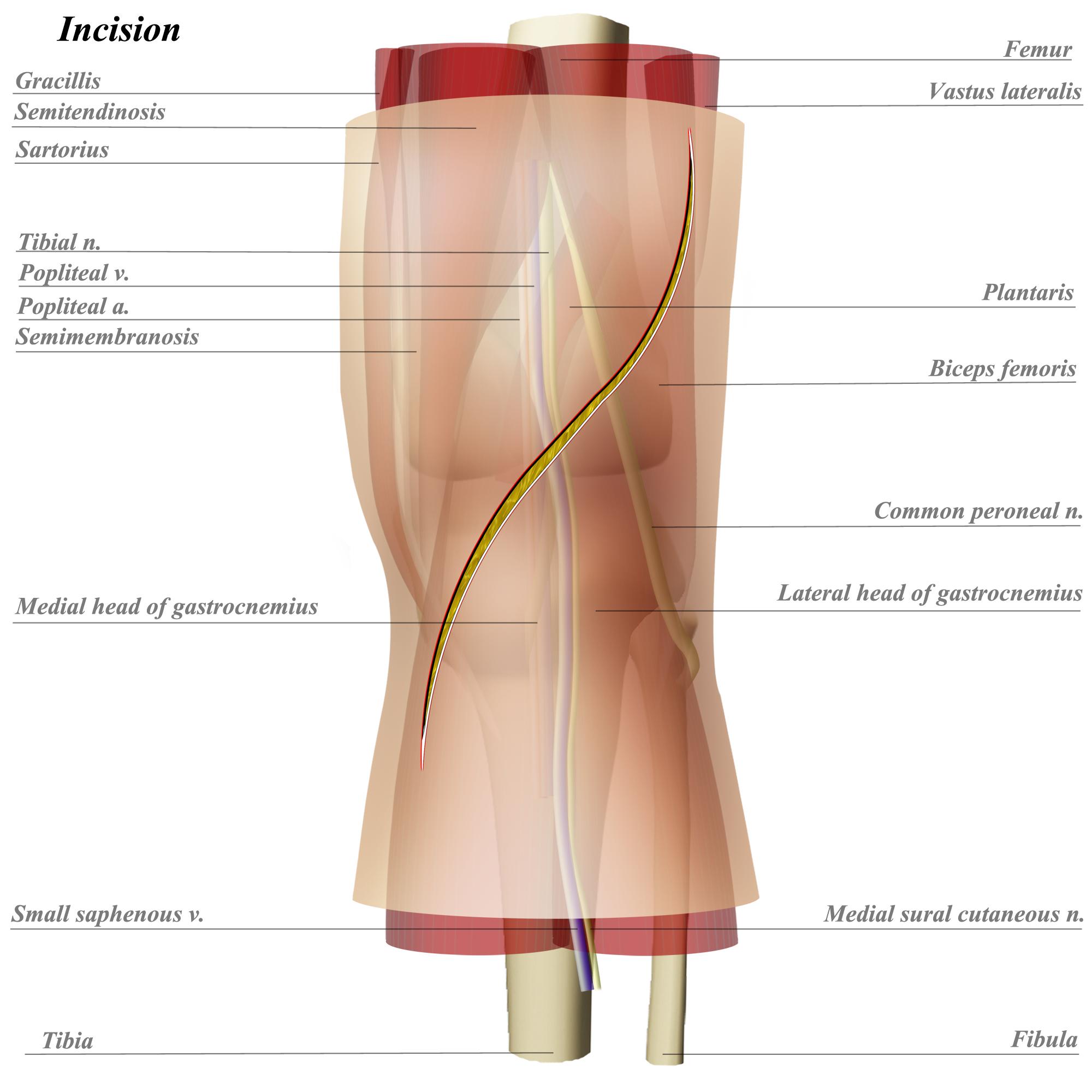 Knee Posterior Approach Approaches Orthobullets