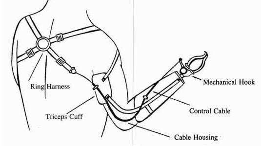 Rehab & Prosthetics Basic Science Orthobullets