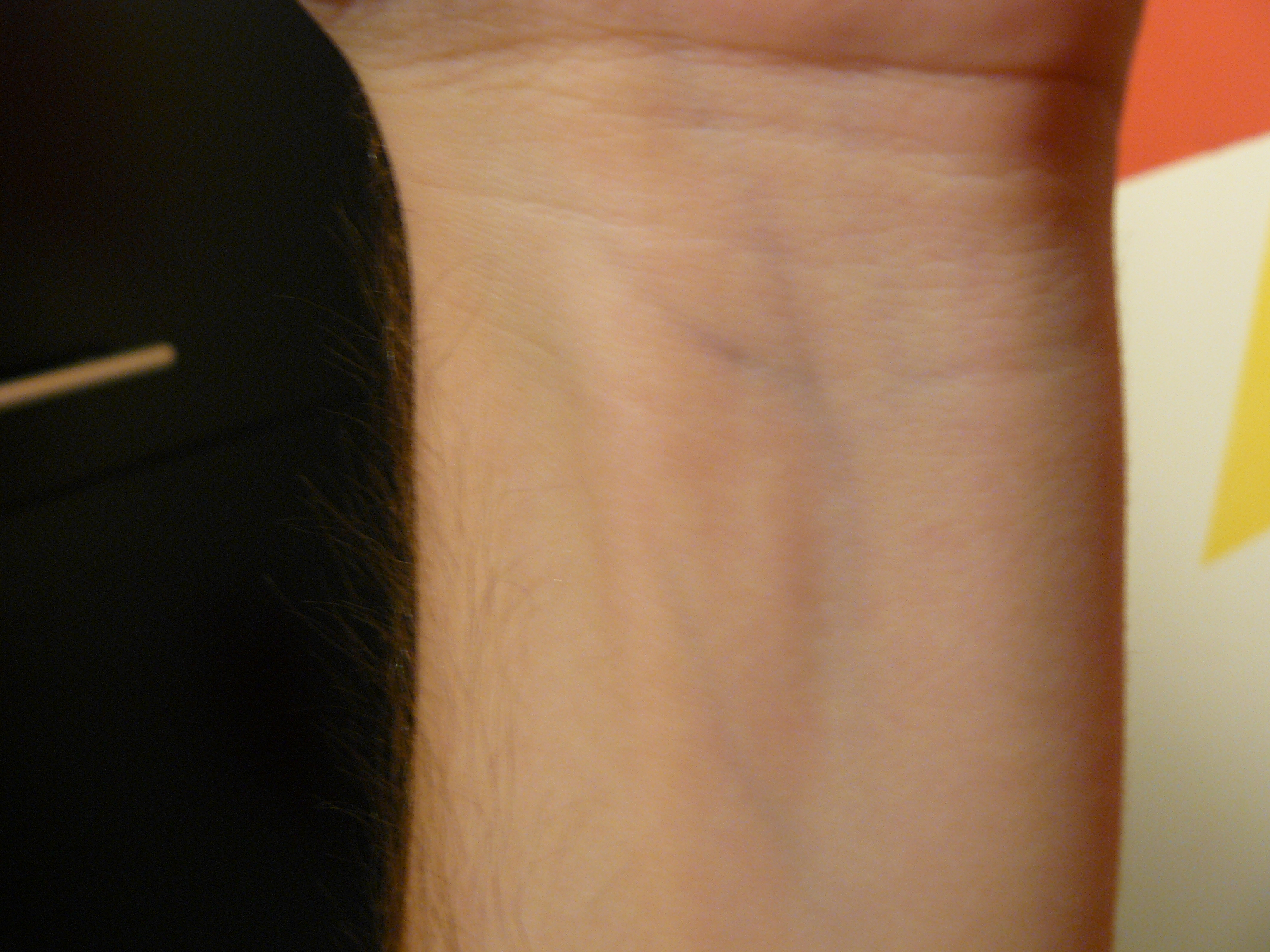 FileImage of a wrist with blue veins visible.JPG Wikipedia