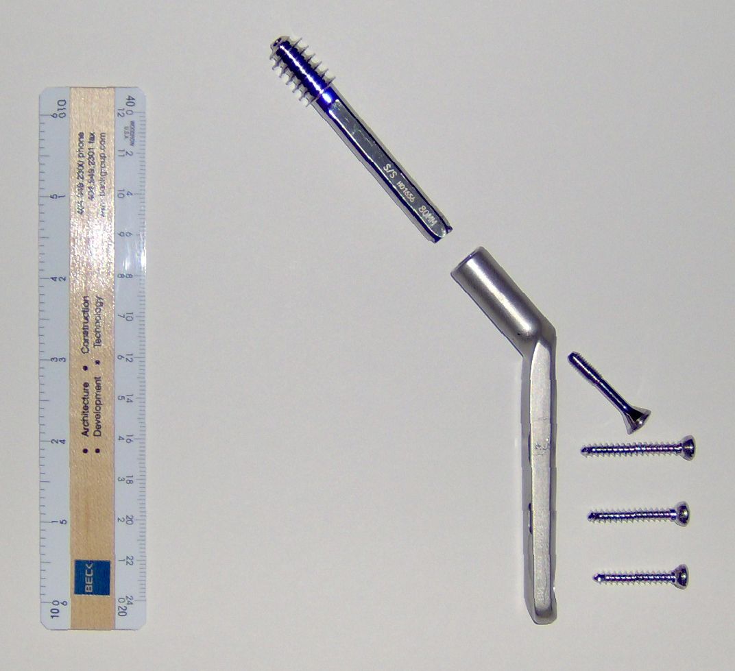 Dynamic hip screw Wikipedia