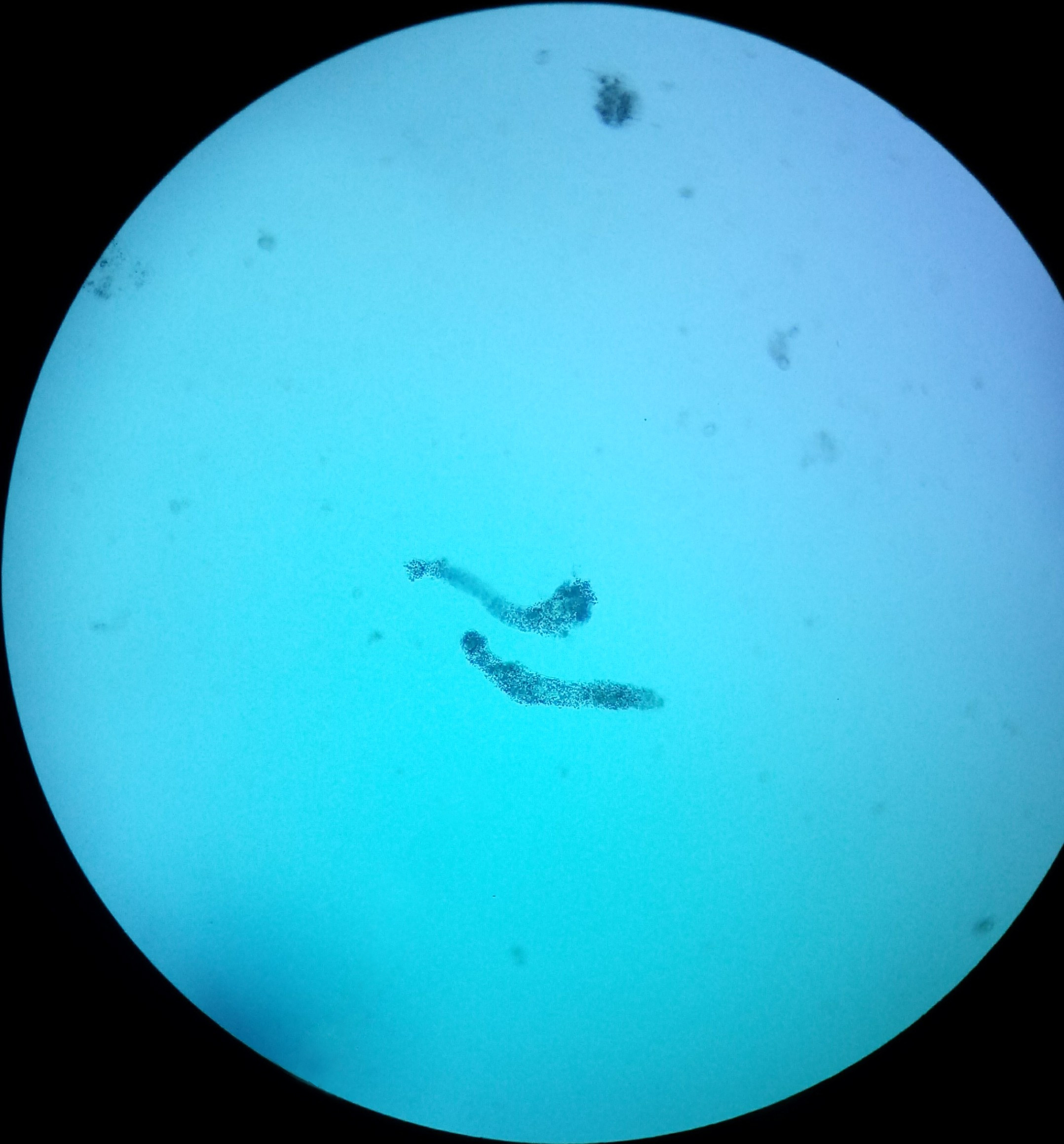 Microscope Light Microscope Amoeba Micropedia