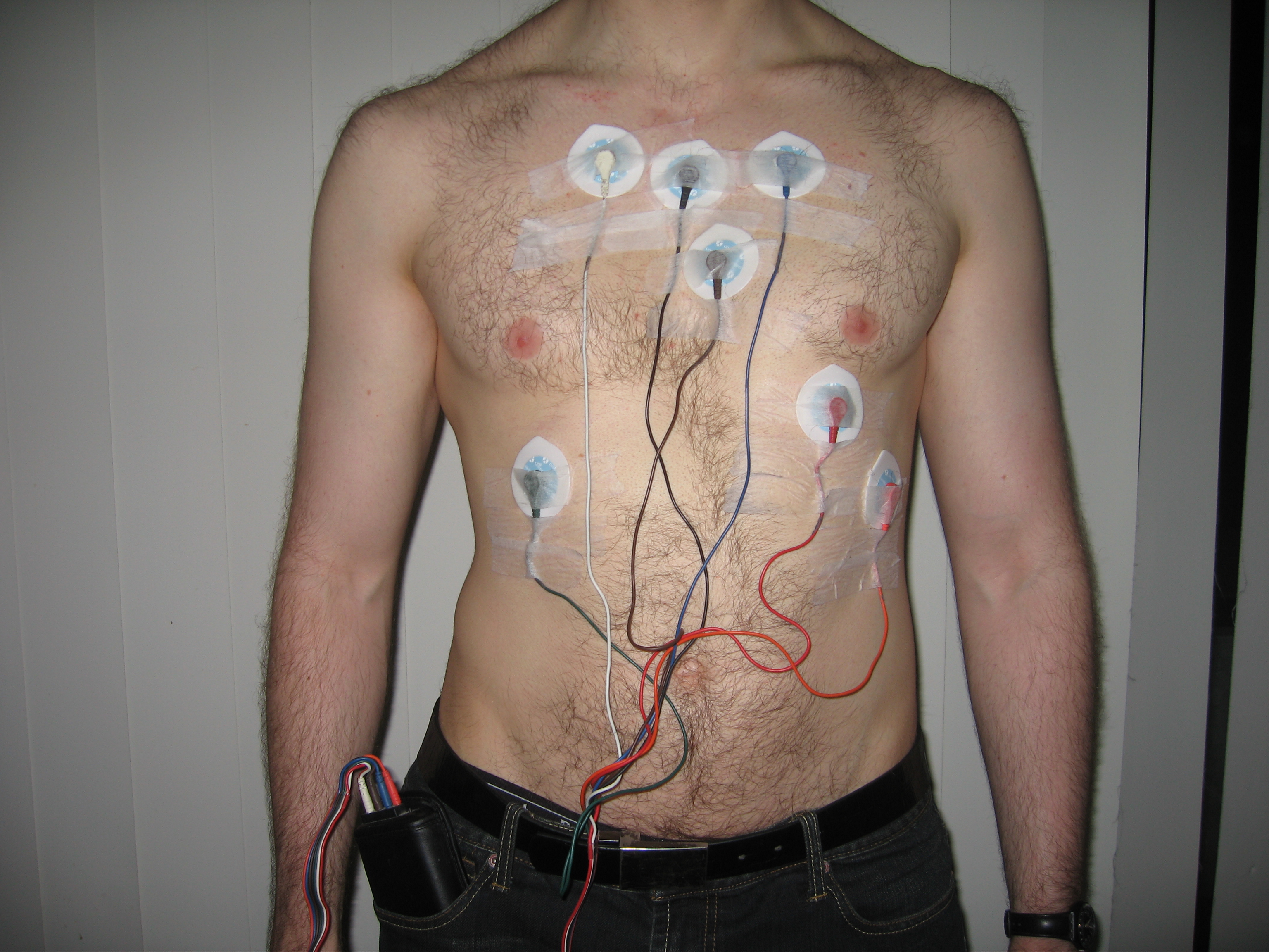 Holter-Ecg - Wikipedia