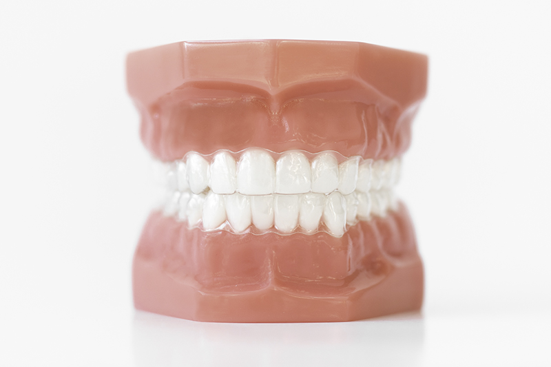 Best Braces & Invisalign Blue Springs & Independence