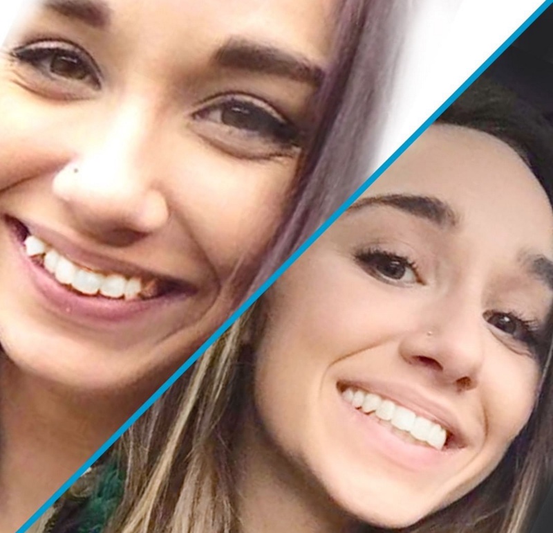 From Start to Finish: What to Expect From the Invisalign.