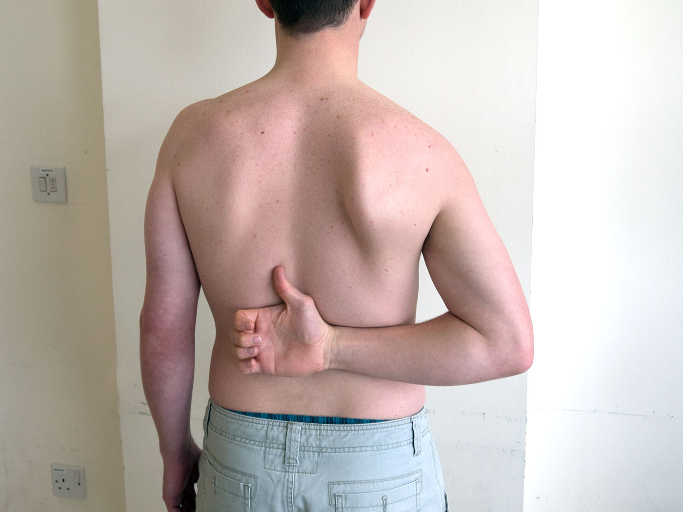 Shoulder Examination — Medistudents