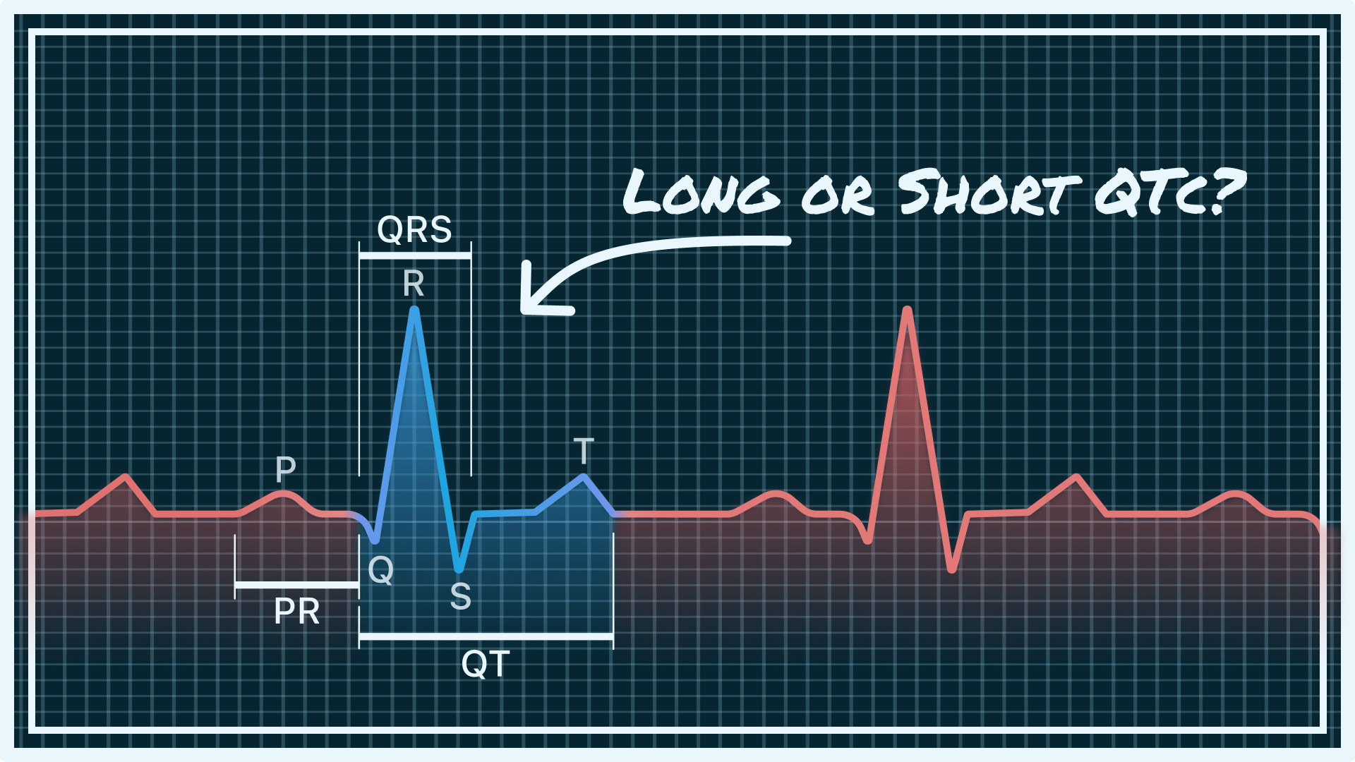 QTc Interval on Your Watch ECG Short, Normal, and Prolonged Qaly