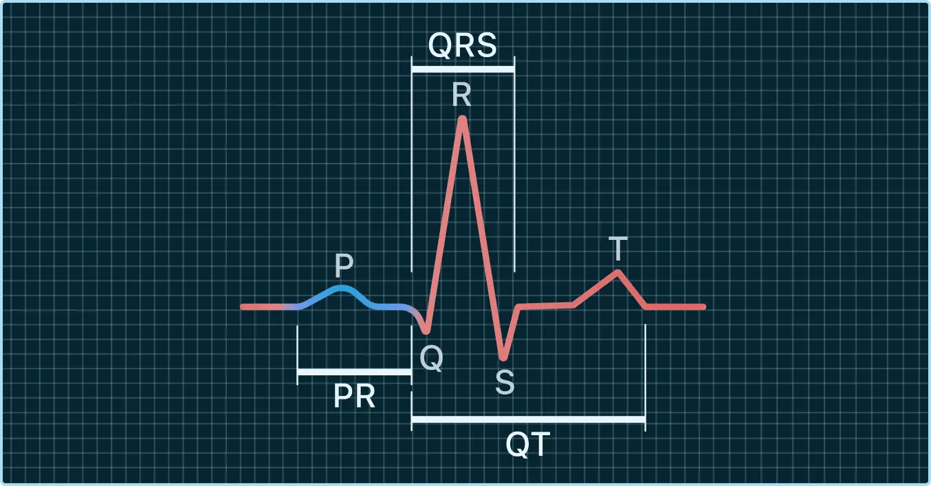 What PR, QRS, and QTc Intervals Mean on Your Watch ECG Qaly