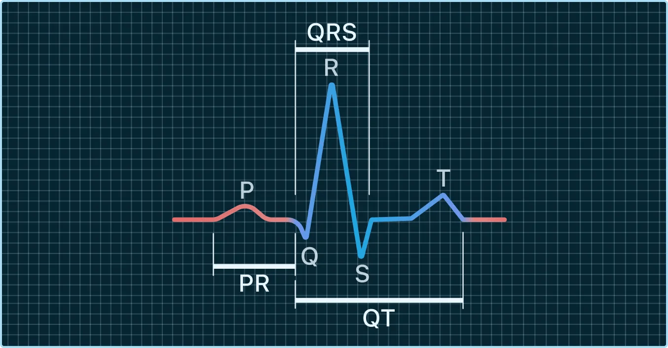 What PR, QRS, and QTc Intervals Mean on Your Watch ECG Qaly