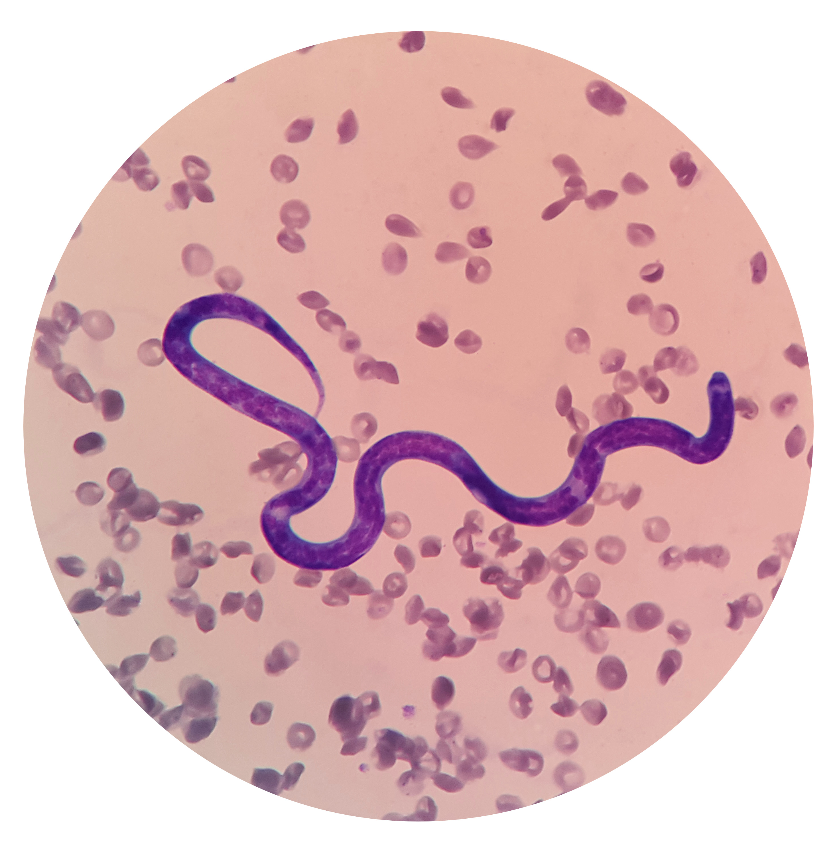 Blood Parasites in Dogs Rural versus Urban Considerations