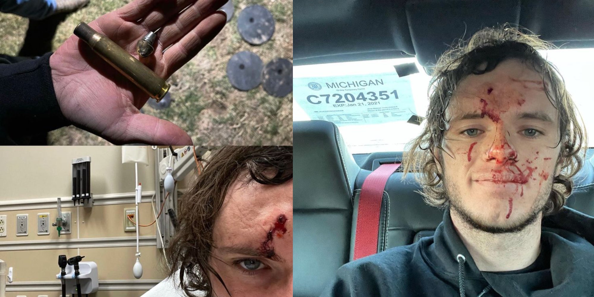 YouTuber Shoots Himself In The Head in Freak Gun Accident