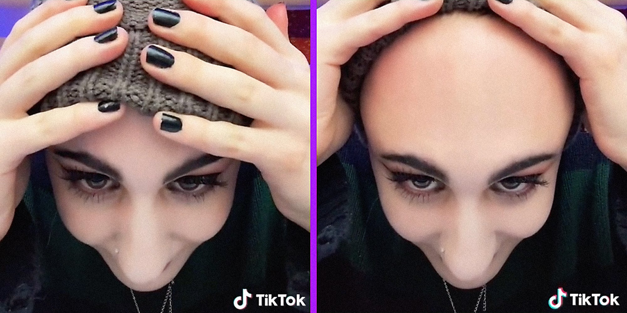 Big Forehead TikTok Is All About Embracing the Space