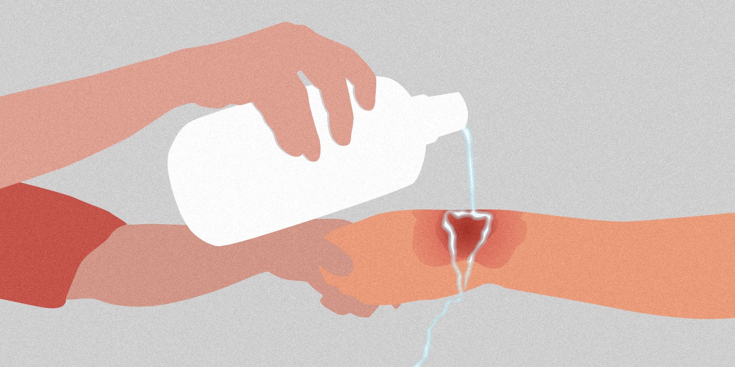 The Icy History of the 'Apply Cold Water to Burn' Meme