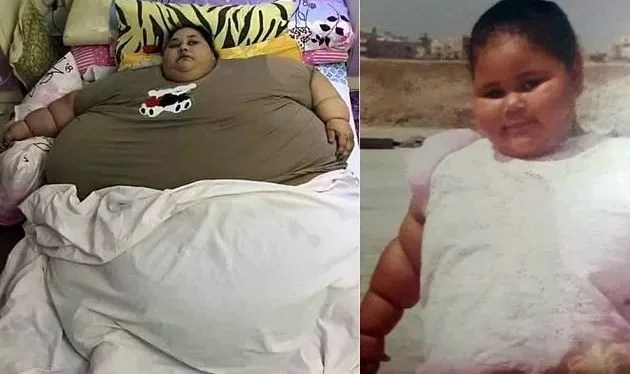 Mulher mais obesa do mundo não sai de casa há 25 anos