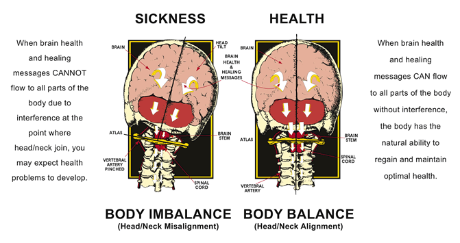 Upper Cervical Chiropractic Upper Cervical Chiropractic