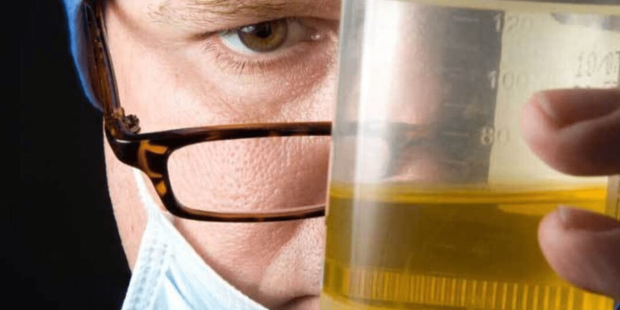 Causas del mal olor en la orina Dr. Luis Alberto Guerra Zepeda