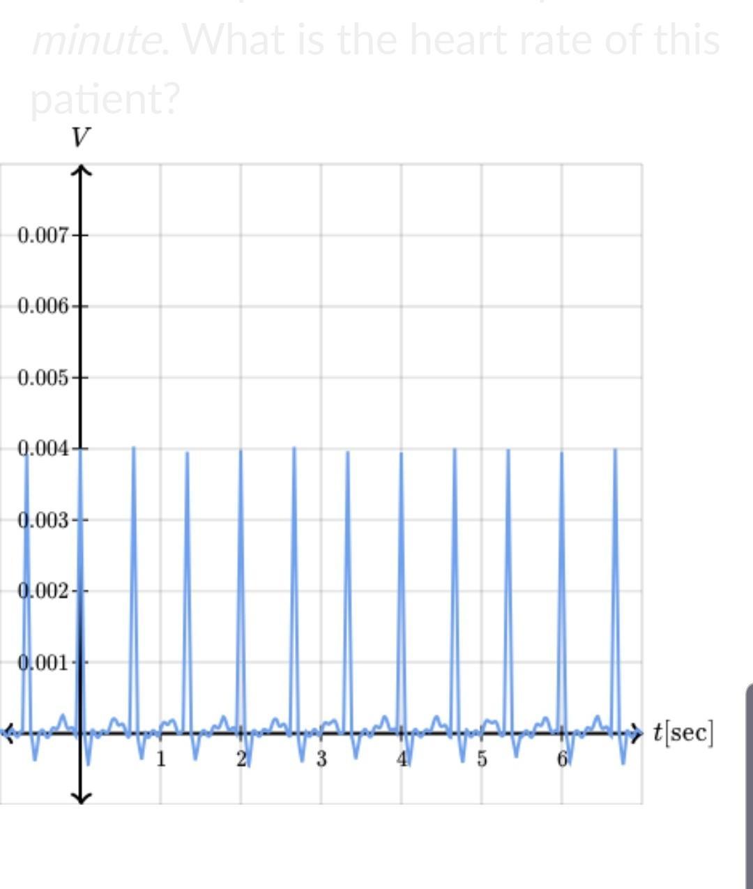 A doctor observes a graph that shows the electrical activity (in volts