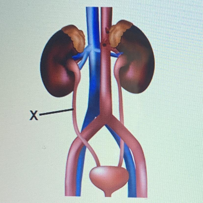 The picture represents the excretory system. Which is represented by