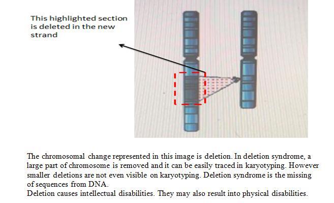 Which chromosomal change is represented? A.) deletion B) translocation