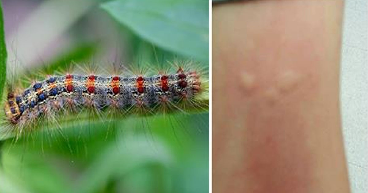 Officials Are Warning People About Gypsy Moth Caterpillars And The