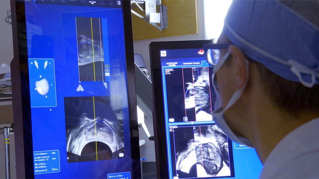 Man Benefits from Focused Ultrasound Therapy for Prostate Cancer HIFU
