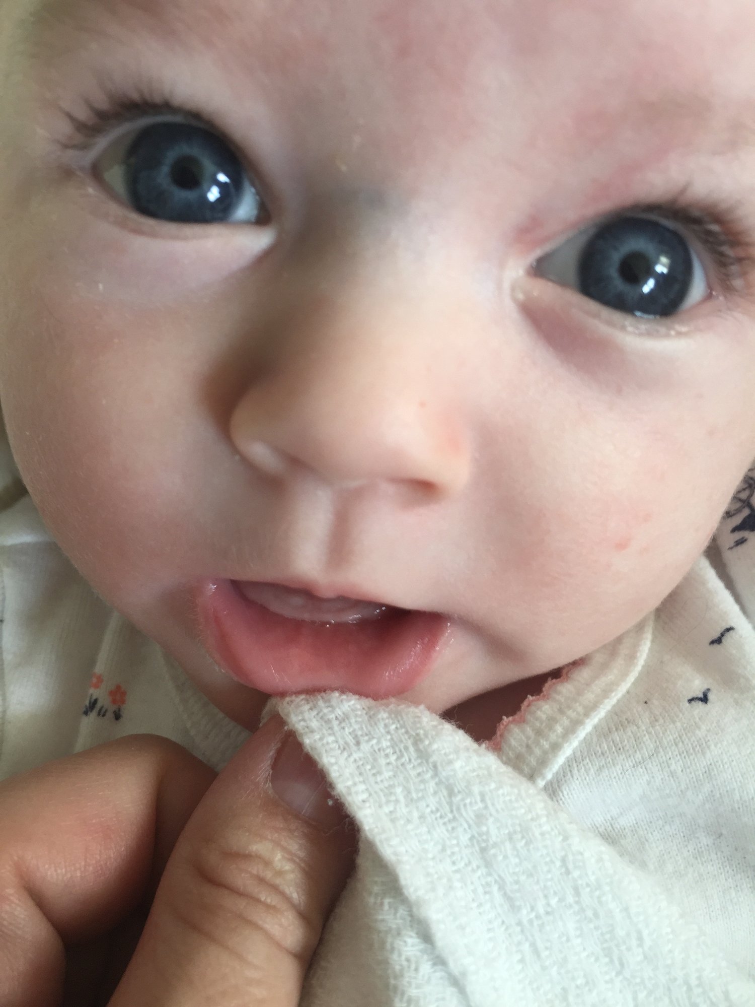 Teeth?!?! — The Bump