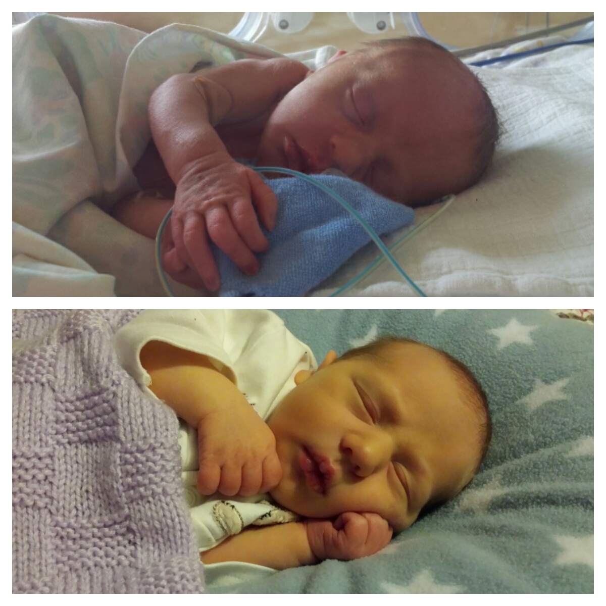 Baby Born At 32 Weeks Baby Viewer