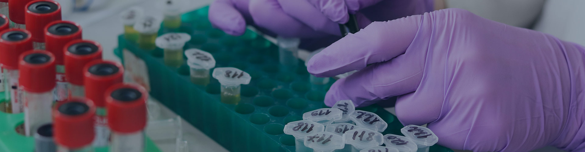 Specimen Collection Human Tissue Procurement BioRepository