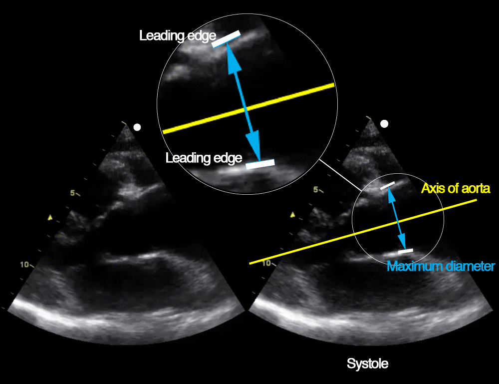 LessonCardiacUS Archives USabcd