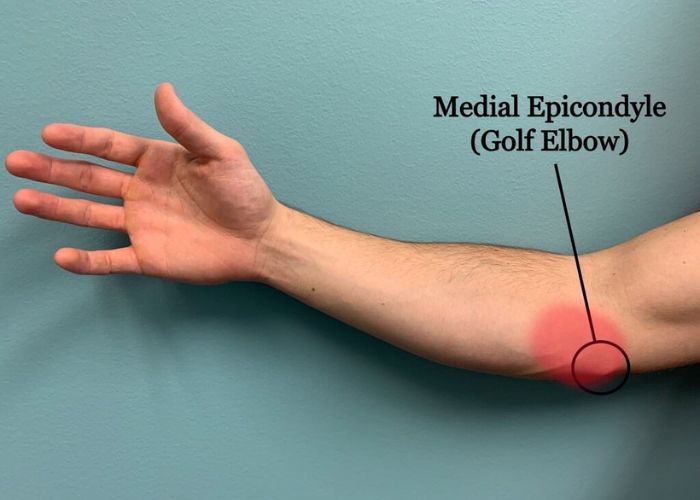 Can Golf Cause Tennis Elbow USA Golf Digest