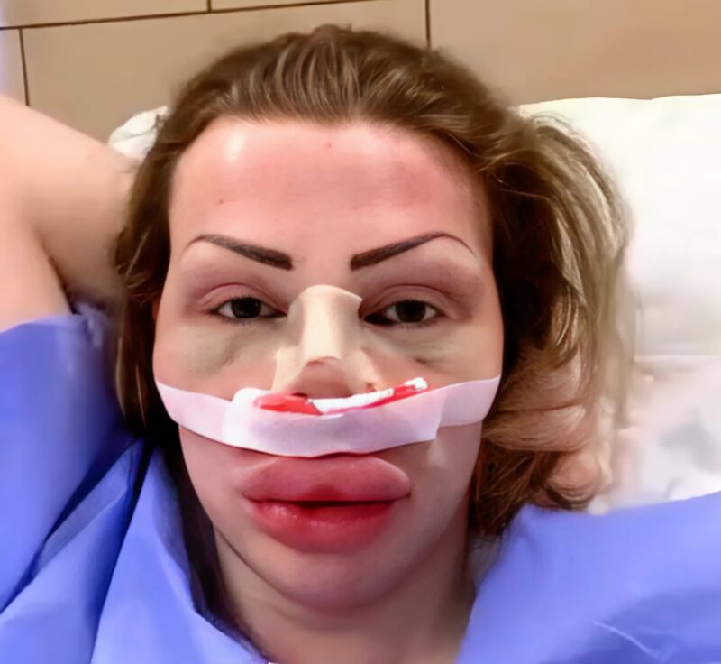 Shocking Transformation He Spent Millions of Dollars to Get Surgeries(04)