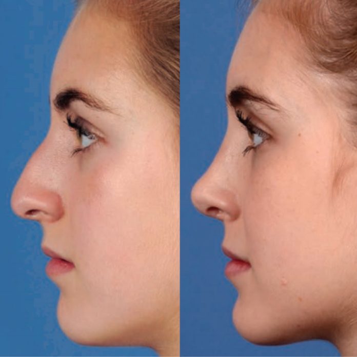 The Key Differences Between Cosmetic and Reconstructive Plastic Surgery