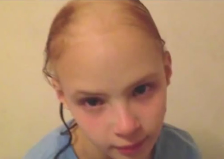 Why Is My Little Girl Losing Hair at Kathryn Fairfield blog