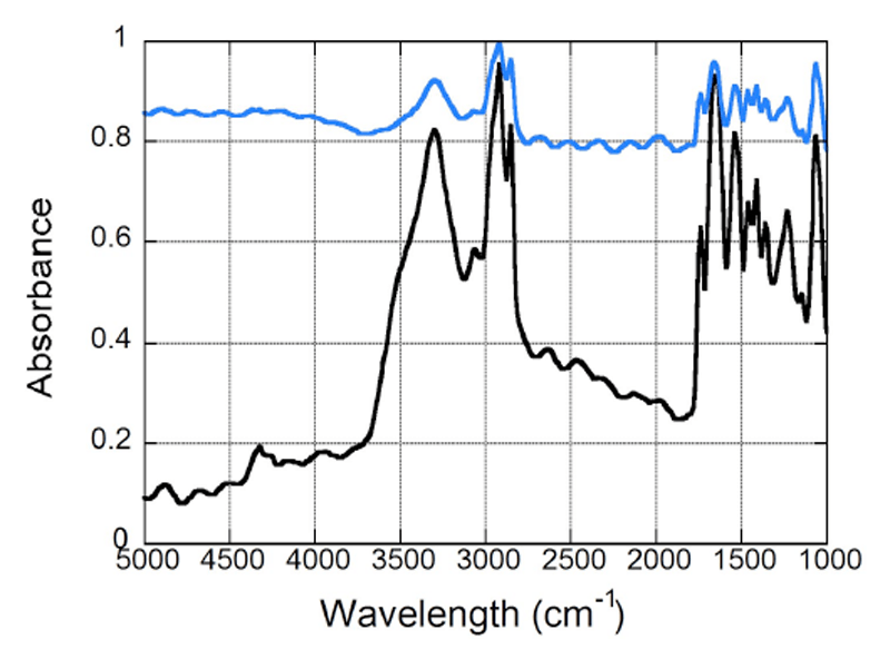 動脈壁 弾性繊維