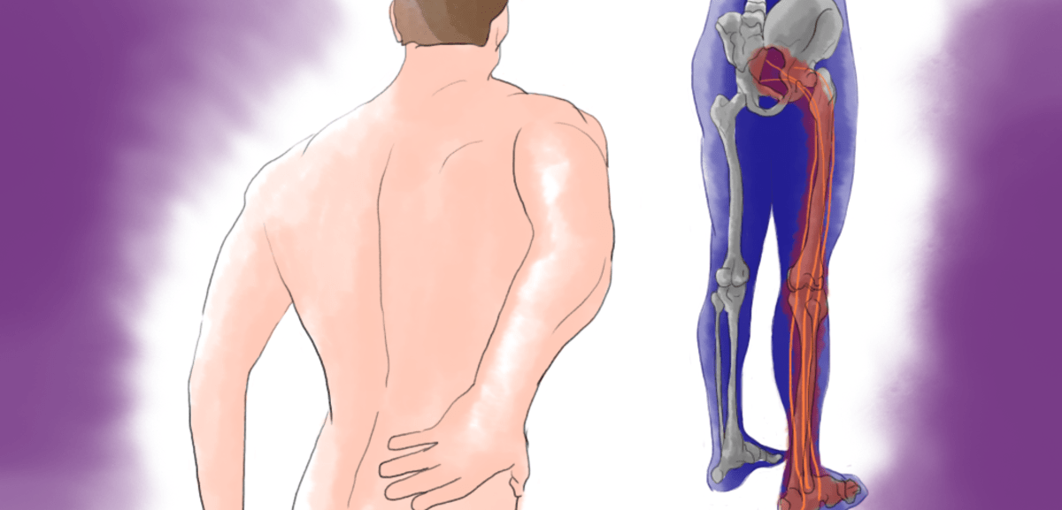 lower left abdominal pain radiating to back and leg