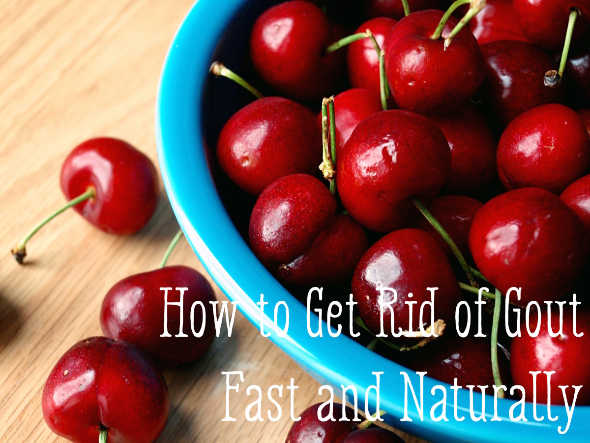 How to Get Rid of Gout Quickly and Naturally HubPages