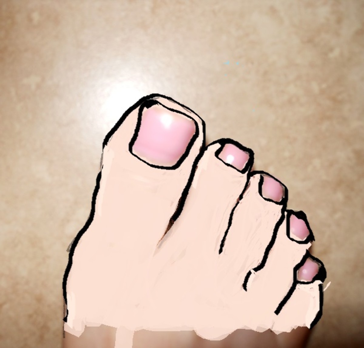 Symptoms You Have a Broken Pinky Toe or Stubbed Toe, Difference in Shooting Pains and the
