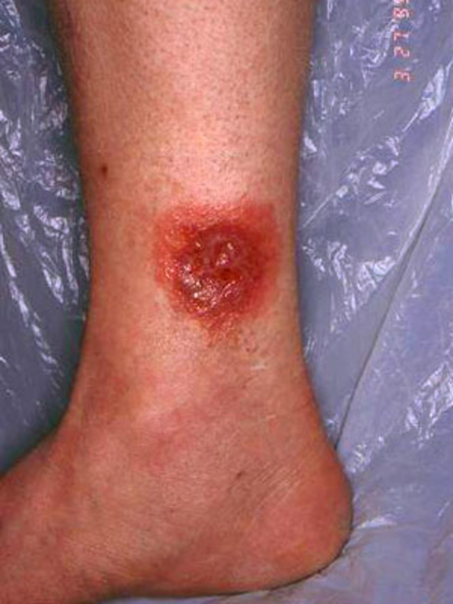 The Wolf Spider, Venomous, but Preys on More Dangerous Spiders HubPages