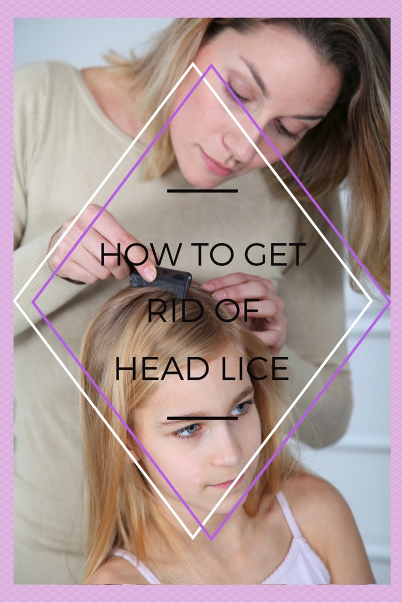 How to Get Rid of Head Lice by Kelly HealDove