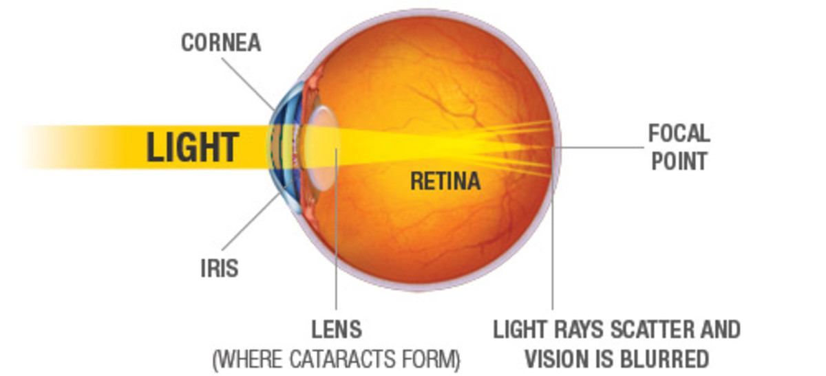 How to Handle Night Blindness and Headlight Glare HealDove