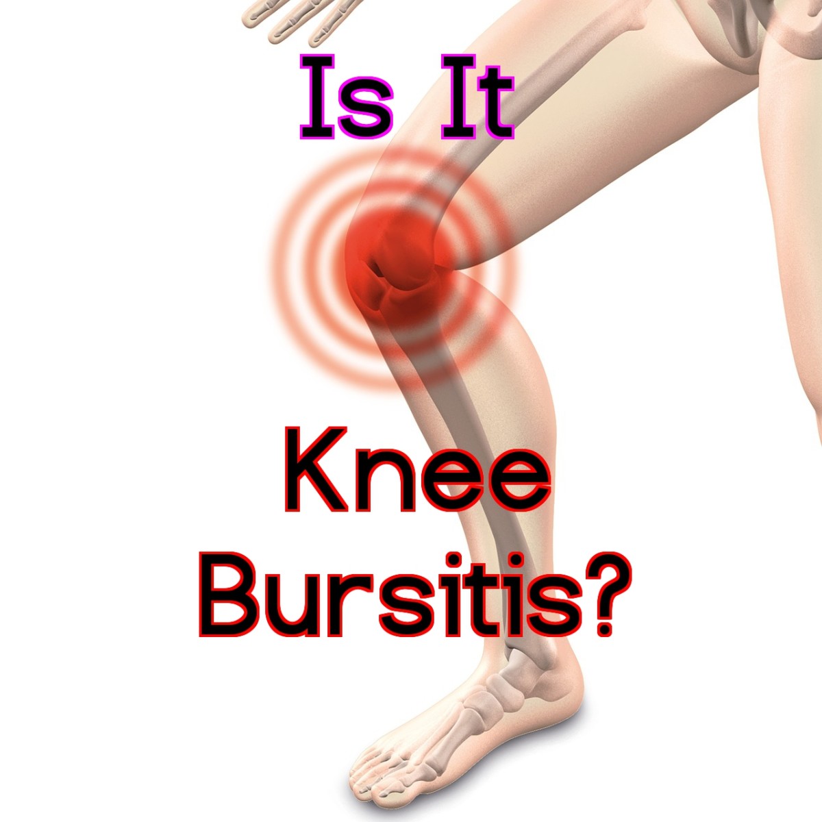 Knee Bursitis Symptoms and Best Treatment Options HealDove