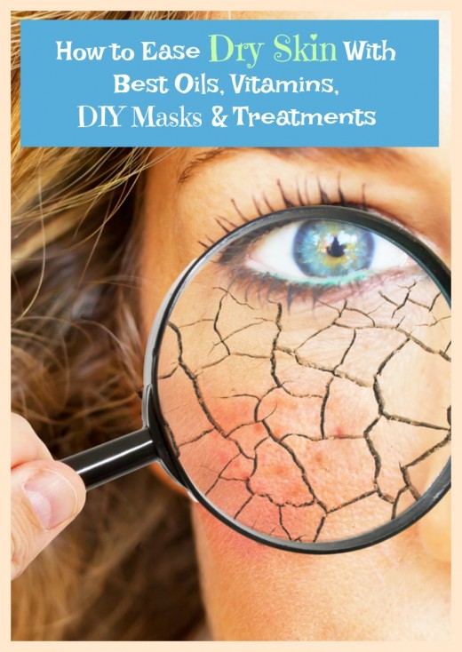 How to Deal with Dry Skin on the Face with Best Solutions and Treatments HubPages
