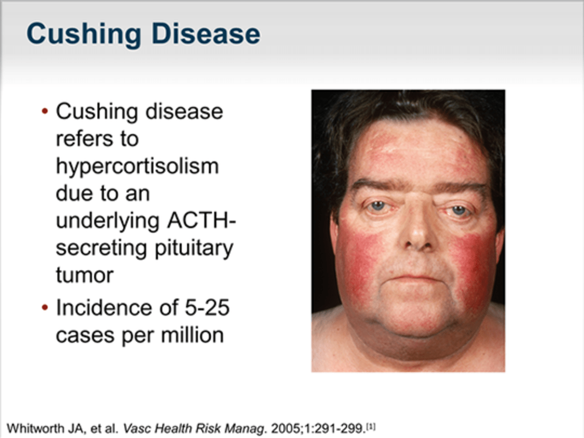 List of Rare Diseases HubPages