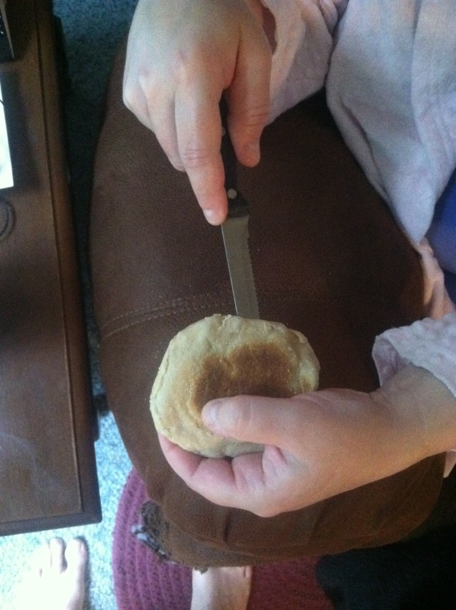 Tendon Injuries of the Hand HealDove