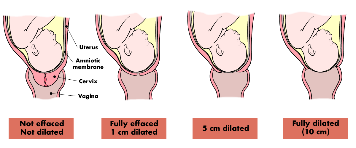 I'm Effaced and Dilated. When Will I Go Into Labor? WeHaveKids