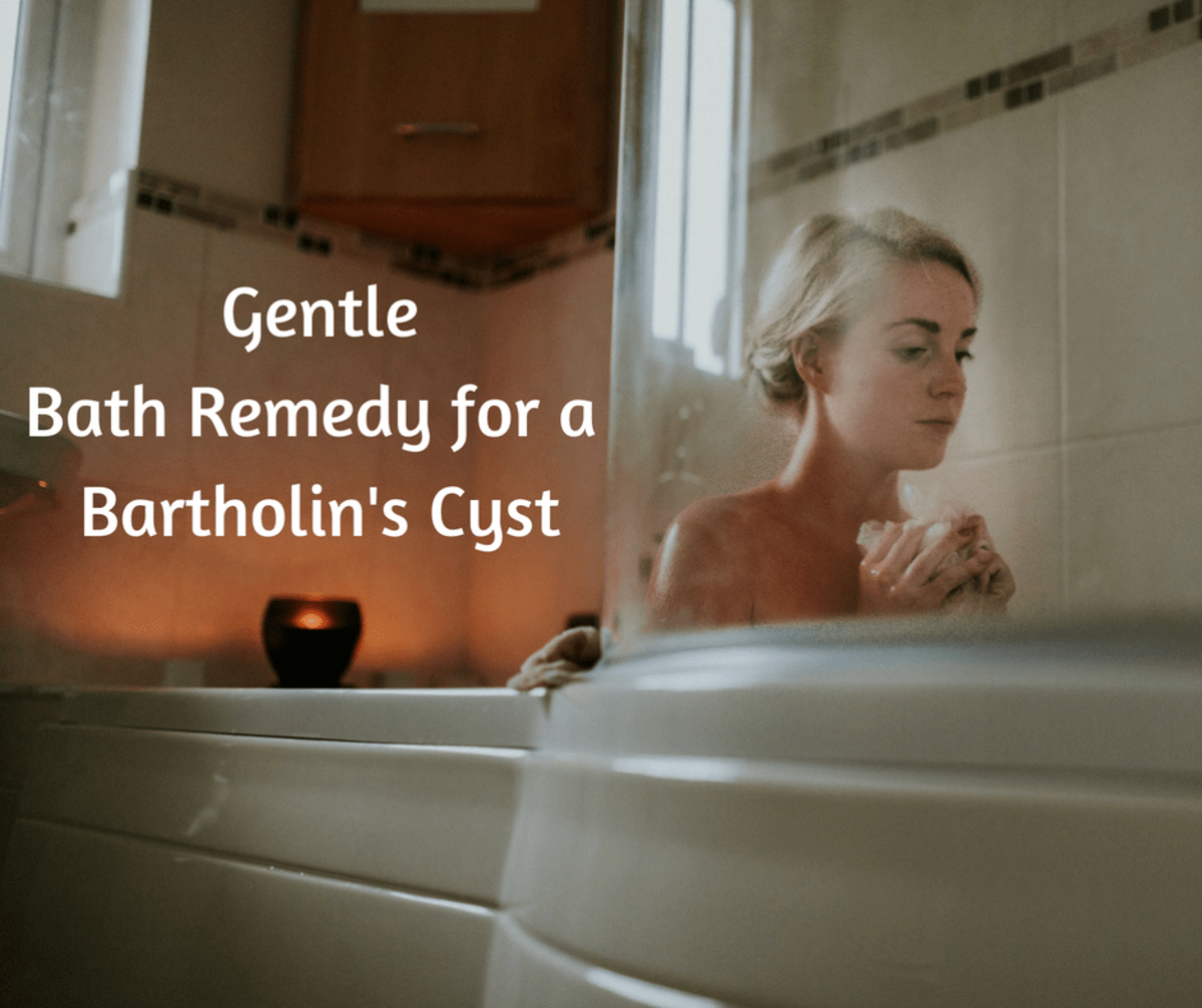 Home Remedies for a Bartholin's Cyst RemedyGrove