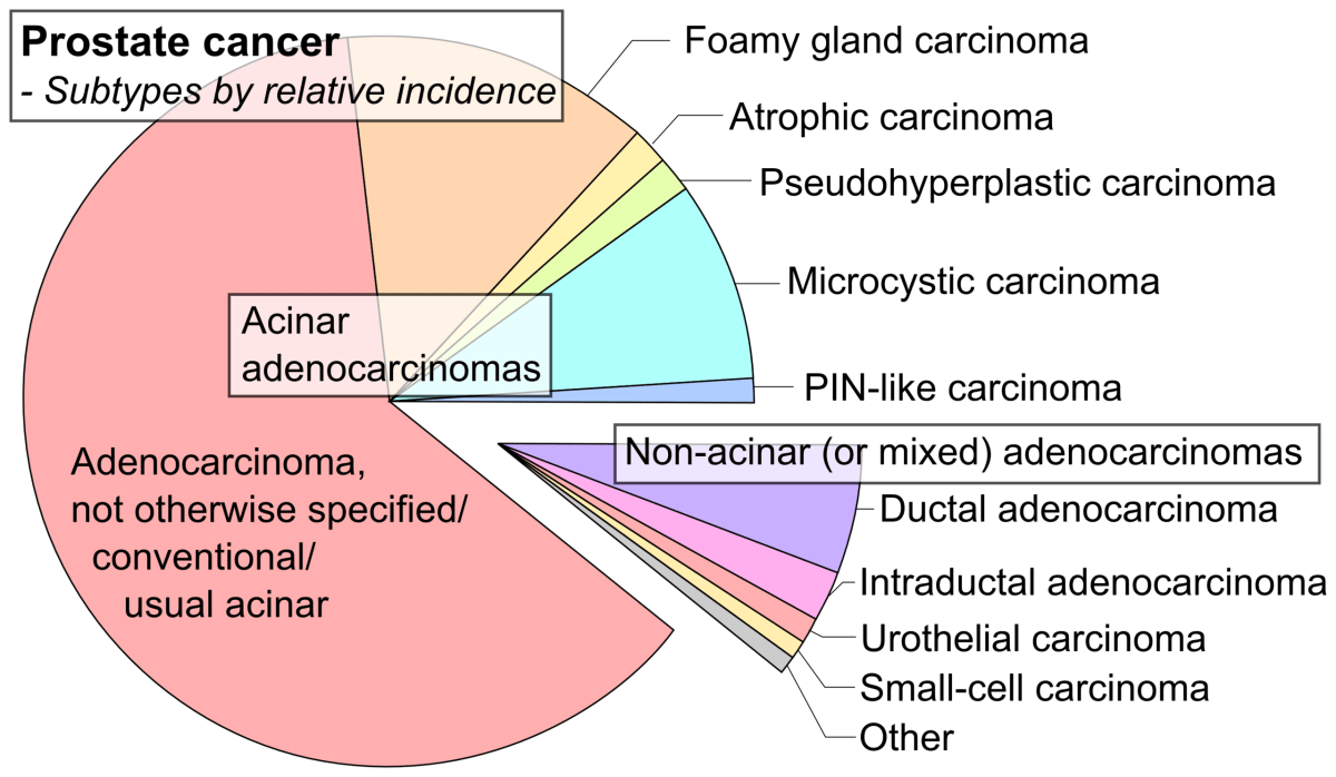 What You Need to Know About Prostate Cancer HubPages