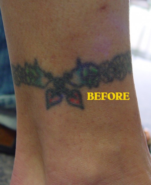 How to Cover Up Old Tattoos With a New Tattoo Design HubPages