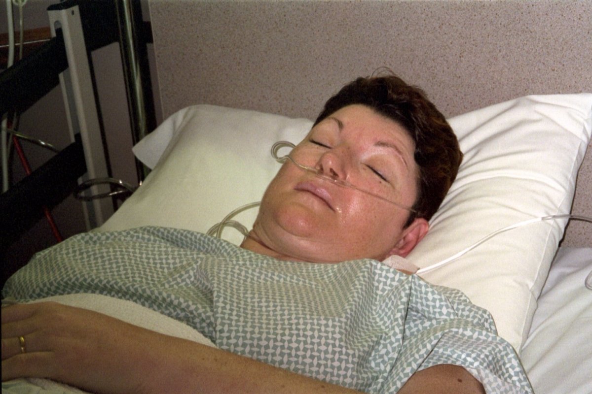 How to Know If You Have a Bowel Obstruction HealDove