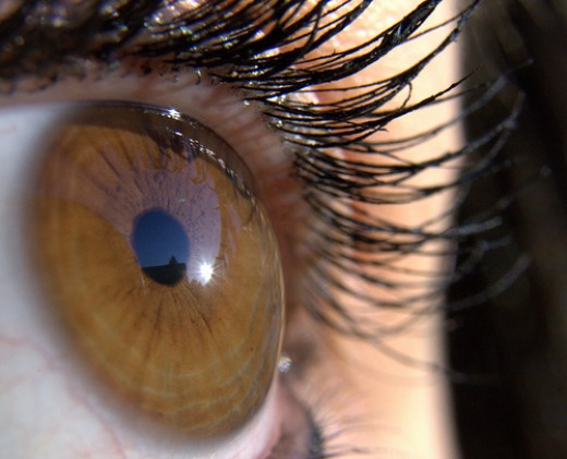 Cataract Surgery Cost Dallas/Fort Worth HubPages
